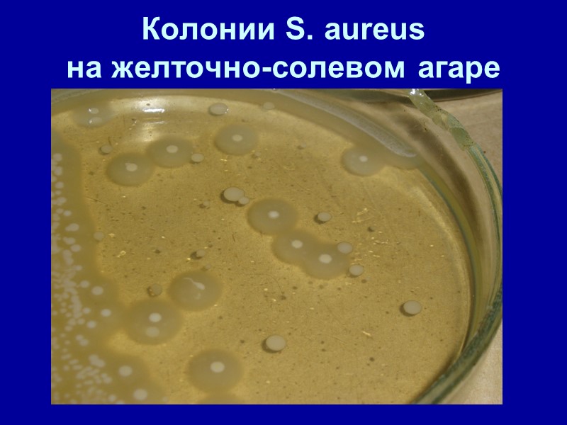 Колонии S. aureus   на желточно-солевом агаре